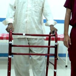 डॉ. उल्हास पाटील रुग्णालयात रिव्हीजन टीएचआर शस्त्रक्रिया यशस्वी