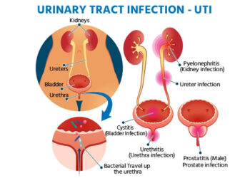 मूत्रमार्गाचा संसर्ग होऊ शकतो, जाणून घ्या लक्षणे…
