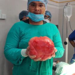 रुग्णाच्या पोटातून चार किलोचा गोळा काढण्यात वैद्यकीय पथकाला यश