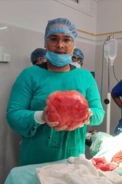 रुग्णाच्या पोटातून चार किलोचा गोळा काढण्यात वैद्यकीय पथकाला यश