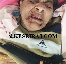 रेल्वेत चढताना पाय घसरला, वृद्ध गंभीर जखमी