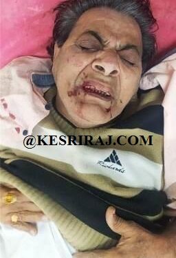 रेल्वेत चढताना पाय घसरला, वृद्ध गंभीर जखमी