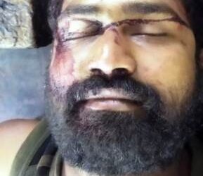 ट्रकवरील दोर सोडताना सुटली आयुष्याचीच दोरी ;  तरुण चालकाचा विजेच्या धक्क्याने मृत्यू