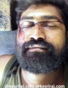 ट्रकवरील दोर सोडताना सुटली आयुष्याचीच दोरी ; तरुण चालकाचा विजेच्या धक्क्याने मृत्यू