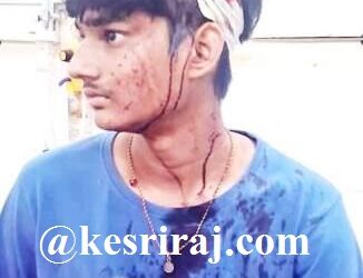 किरकोळ कारणावरून तरुणाच्या डोक्यात मारला लोखंडी रॉड