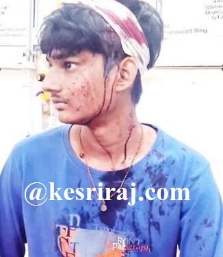 किरकोळ कारणावरून तरुणाच्या डोक्यात मारला लोखंडी रॉड