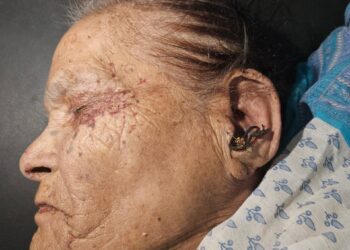 ८० वर्षीय आजीचा खून करीत तिच्या अंगावरचे सोने विकून परत आला रुग्णालयात..!