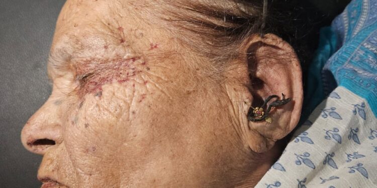 ८० वर्षीय आजीचा खून करीत तिच्या अंगावरचे सोने विकून परत आला रुग्णालयात..!