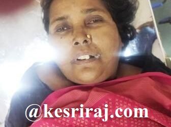 गुळण्या करण्यासाठी चुकून पिले फिनाईलचे पाणी, महिलेचा मृत्यू !