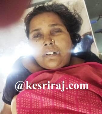 गुळण्या करण्यासाठी चुकून पिले फिनाईलचे पाणी, महिलेचा मृत्यू !