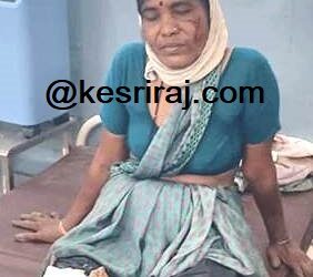 शेतकरी महिलेवर शेतात रानडुकराने केला हल्ला, गंभीर जखमी