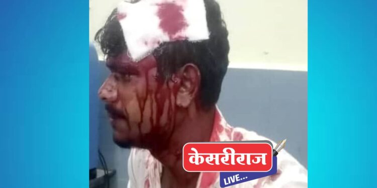 अंडा भुर्जीचा वाद : विक्रेत्याने लोखंडी तवा टाकला ग्राहकाच्या डोक्यात !