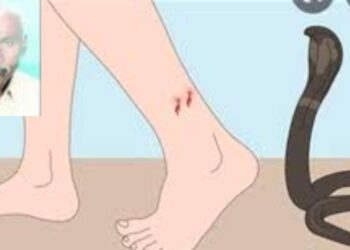 सर्पदंश झालेल्या प्रौढाचा उपचारादरम्यान मृत्यू, डॉक्टरांवर हलगर्जीपणाचा आरोप