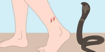 सर्पदंश झाल्याने शेतमजूराचा उपचारादरम्यान मृत्यू