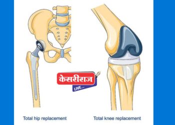 गुडघा अन् खुबा प्रत्यारोपण होणार योजनेंतर्गत मोफत