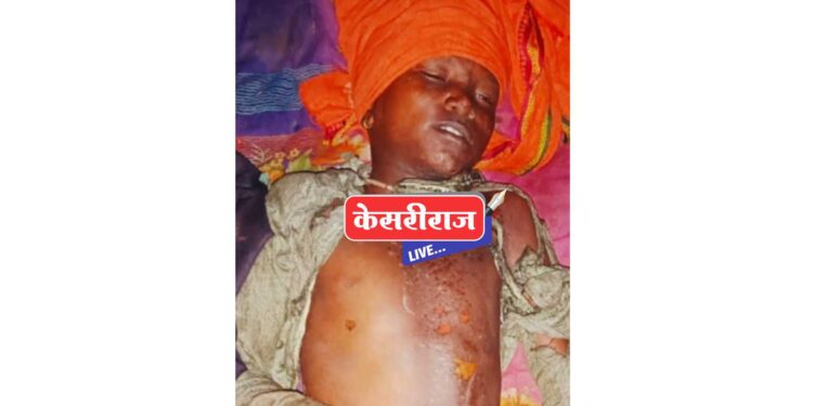 वीज पडून १४ वर्षीय मेंढपाळाच्या मुलाचा मृत्यू