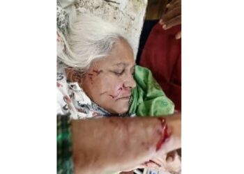 थरार, ८० वर्षीय वृद्धेवर भटक्या कुत्र्याचा प्राणघातक हल्ला !