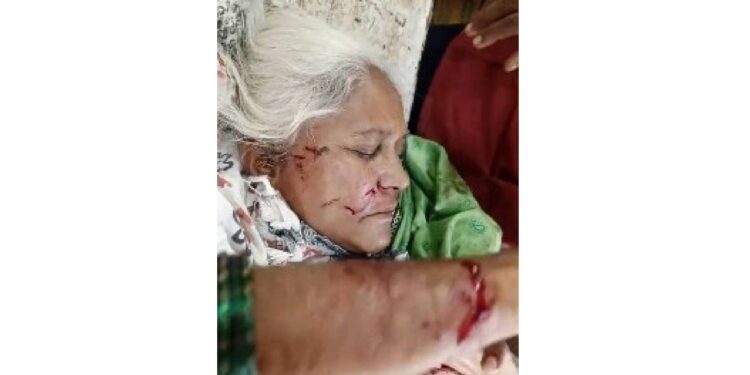 थरार, ८० वर्षीय वृद्धेवर भटक्या कुत्र्याचा प्राणघातक हल्ला !