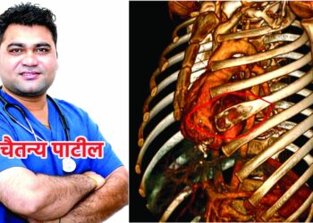 बरगडया फ्रॅक्चर झालेल्या अत्यावस्थ रूग्णावर यशस्वी उपचार