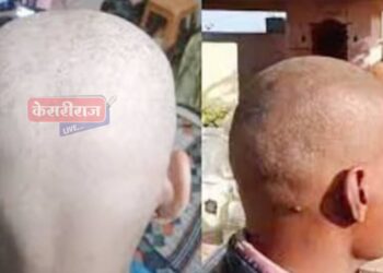 पंजाब, हरयाणातील रेशनच्या “त्या” गव्हामुळे टक्कल पडण्याचे घडले प्रकार !