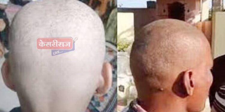 पंजाब, हरयाणातील रेशनच्या “त्या” गव्हामुळे टक्कल पडण्याचे घडले प्रकार !