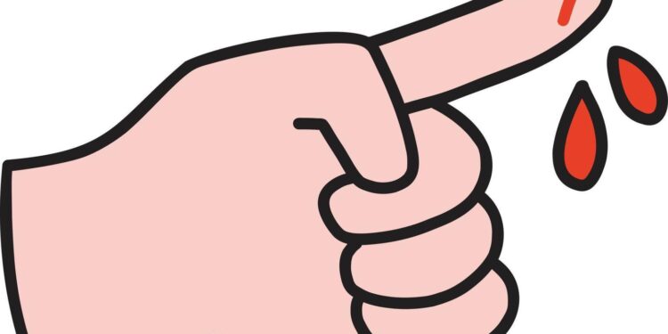 पतीने कडाडून चावा घेत पत्नीचे बोटच तोडले, भांडण सोडवणे पडले महागात !