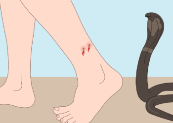 शेतातील घरात सर्पदंश झाल्याने १३ वर्षीय बालिकेचा उपचारदरम्यान मृत्यू !