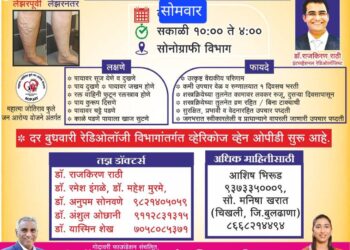 डॉ. उल्हास पाटील वैद्यकीय महाविद्यालयात आज व्हेरिकोज व्हेन्स तपासणी शिबिर