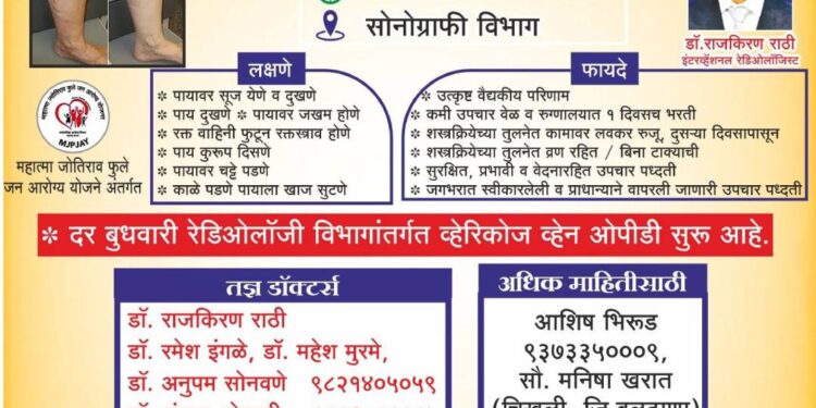 डॉ. उल्हास पाटील वैद्यकीय महाविद्यालयात आज व्हेरिकोज व्हेन्स तपासणी शिबिर