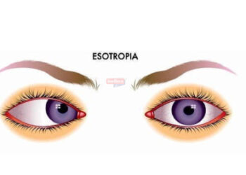 सेरेब्रल पाल्सी विकाराने ग्रस्त तरूणाची मेरी आत्मकथा- शान्तनु वगदे आत्मकथा