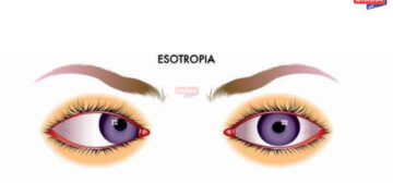 सेरेब्रल पाल्सी विकाराने ग्रस्त तरूणाची मेरी आत्मकथा- शान्तनु वगदे आत्मकथा