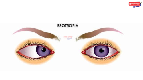 सेरेब्रल पाल्सी विकाराने ग्रस्त तरूणाची मेरी आत्मकथा- शान्तनु वगदे आत्मकथा