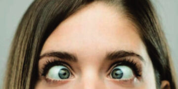 डॉ. उल्हास पाटील वैद्यकिय महा. व रूग्णालयात ३,४,५ एप्रिलला तिरळेपणासाठी मोफत शस्त्रक्रिया शिबिर