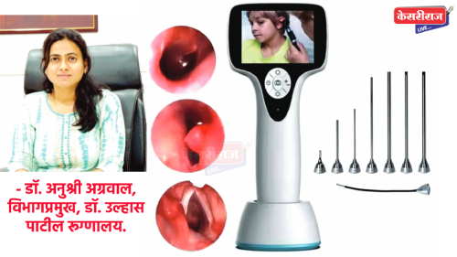 डॉ. उल्हास पाटील रूग्णालयात व्हीडीओ एन्डोस्कोपीद्वारे होणार अचूक निदान