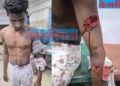 जुन्या भांडणाच्या कारणावरून दापोऱ्याच्या तरुणावर चॉपरने हल्ला; तिघांविरुद्ध गुन्हा दाखल