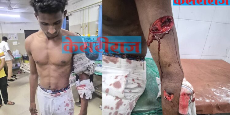 जुन्या भांडणाच्या कारणावरून दापोऱ्याच्या तरुणावर चॉपरने हल्ला; तिघांविरुद्ध गुन्हा दाखल