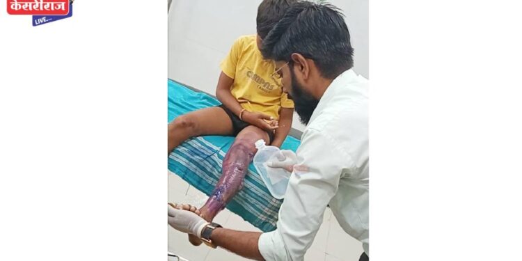 मधुमेह, शस्त्रक्रियेनंतर, बेडसोर्स, संसर्गजन्य तसेच दीर्घकाळ न भरणार्या जखमांसाठी केले जातात उपचार
