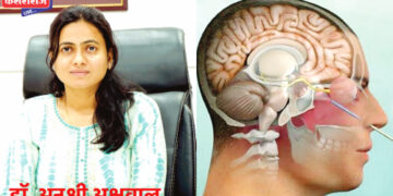 तरूणीच्या नाक-कानातून वाहणारे मेंदूतील पाणी शस्त्रक्रियेने बंद