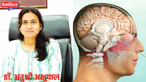 तरूणीच्या नाक-कानातून वाहणारे मेंदूतील पाणी शस्त्रक्रियेने बंद